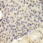 KPNA1 Polyclonal Antibody