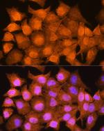 AIRE Antibody in Immunocytochemistry (ICC/IF)