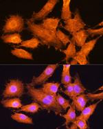 AIRE Antibody in Immunocytochemistry (ICC/IF)