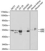 AIRE Antibody in Western Blot (WB)