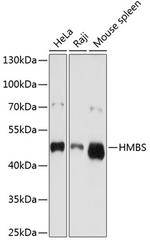 HMBS Polyclonal Antibody