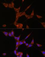 AKR1C3 Polyclonal Antibody