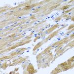 MOK Antibody in Immunohistochemistry (Paraffin) (IHC (P))