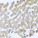 MOK Antibody in Immunohistochemistry (Paraffin) (IHC (P))