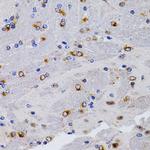 TFF1 Antibody in Immunohistochemistry (Paraffin) (IHC (P))