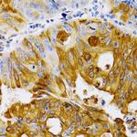TFF1 Antibody in Immunohistochemistry (Paraffin) (IHC (P))
