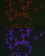 CD20 Polyclonal Antibody
