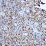 CD20 Antibody in Immunohistochemistry (Paraffin) (IHC (P))