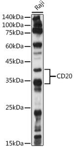 CD20 Antibody in Western Blot (WB)