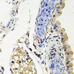 Syndecan 2 Antibody in Immunohistochemistry (Paraffin) (IHC (P))
