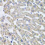 Syndecan 2 Polyclonal Antibody