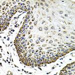 Syndecan 2 Antibody in Immunohistochemistry (Paraffin) (IHC (P))