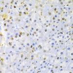 hnRNP D Antibody in Immunohistochemistry (Paraffin) (IHC (P))