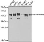 hnRNP D Antibody in Western Blot (WB)