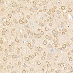 RPGR Antibody in Immunohistochemistry (Paraffin) (IHC (P))