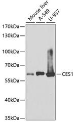 CES1 Polyclonal Antibody