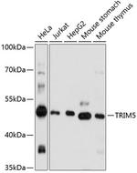 TRIM5 alpha/beta/gamma/delta/epsilon/iota Antibody in Western Blot (WB)