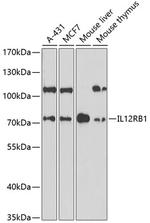 IL12RB1 Polyclonal Antibody