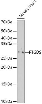 PTGDS Polyclonal Antibody