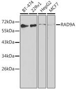 RAD9 Antibody in Western Blot (WB)