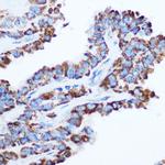 PDHA1 Polyclonal Antibody