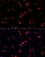 IL-11 Antibody in Immunocytochemistry (ICC/IF)