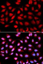 PPP2R4 Polyclonal Antibody