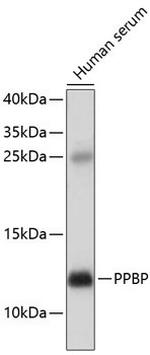 PPBP Polyclonal Antibody
