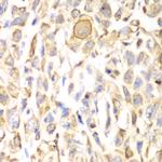 CD151 Polyclonal Antibody