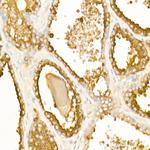 Prostate Specific Acid Phosphatase Polyclonal Antibody