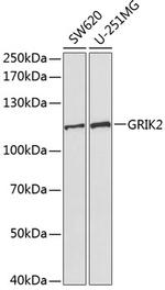 GluR6 Polyclonal Antibody