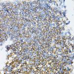 UBE2D1 Antibody in Immunohistochemistry (Paraffin) (IHC (P))