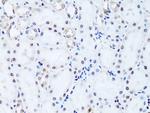 HIST2H2BE Antibody in Immunohistochemistry (Paraffin) (IHC (P))