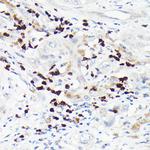 MMP8 Polyclonal Antibody
