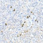 MDC Antibody in Immunohistochemistry (Paraffin) (IHC (P))