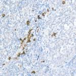 MDC Polyclonal Antibody