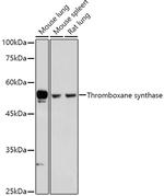 Thromboxane synthase Antibody in Western Blot (WB)