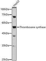 Thromboxane synthase Antibody in Western Blot (WB)