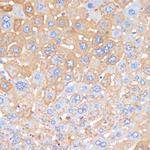 Serum Amyloid P Polyclonal Antibody