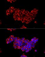 CDA Antibody in Immunocytochemistry (ICC/IF)