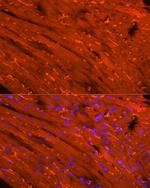 Creatine Kinase MB Polyclonal Antibody