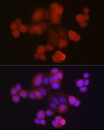 RPS27A Polyclonal Antibody
