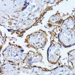 RPS27A Antibody in Immunohistochemistry (Paraffin) (IHC (P))