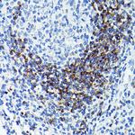 CD79b Antibody in Immunohistochemistry (Paraffin) (IHC (P))