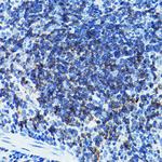 CD79b Polyclonal Antibody