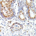 IL13RA2 Polyclonal Antibody