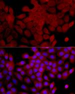 IL1RA Antibody in Immunocytochemistry (ICC/IF)