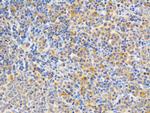 PKC epsilon Antibody in Immunohistochemistry (Paraffin) (IHC (P))