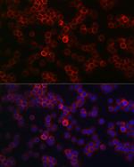 CD45 Antibody in Immunocytochemistry (ICC/IF)