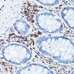 CD45 Antibody in Immunohistochemistry (Paraffin) (IHC (P))